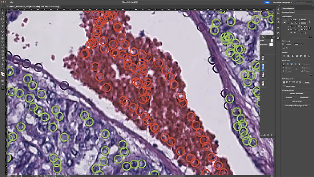 AI in Oncology Lab